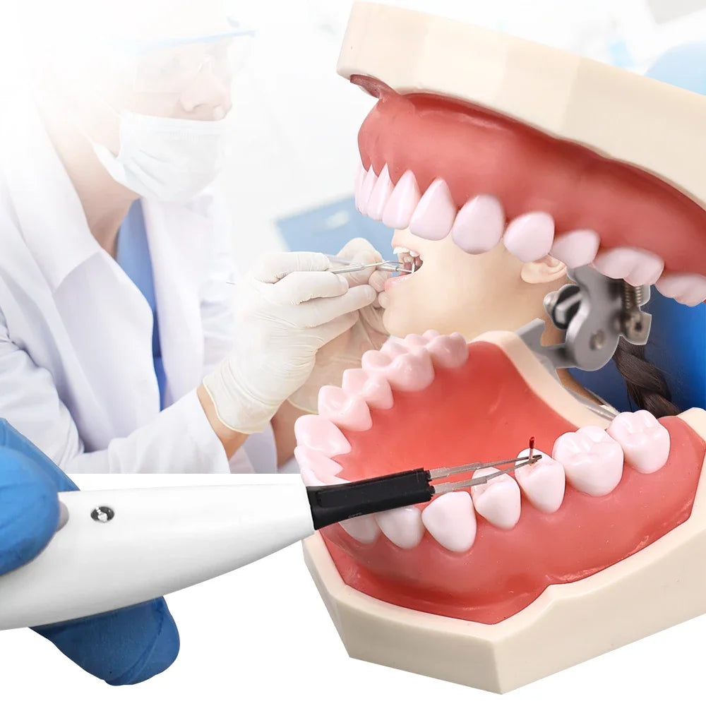 Dental Gutta Percha Cutter Dental Dissolved Breaker Gutta Percha Cutter 4 Tips Oral Gutta Percha Tooth Gum Cutter Dentistry Tool