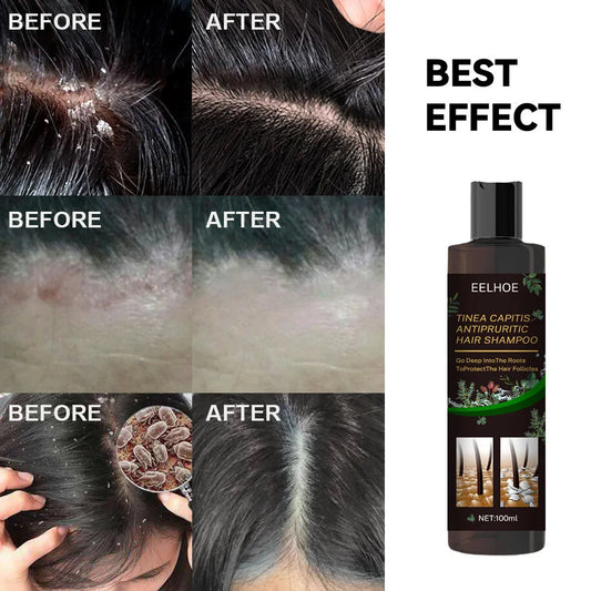 EELHOE Anti It-ching Shampoo Hair Growth Moisturizing Dry Frizzy Repair Damaged Hair Roots Strengthen Cleaning Scalp Treatment