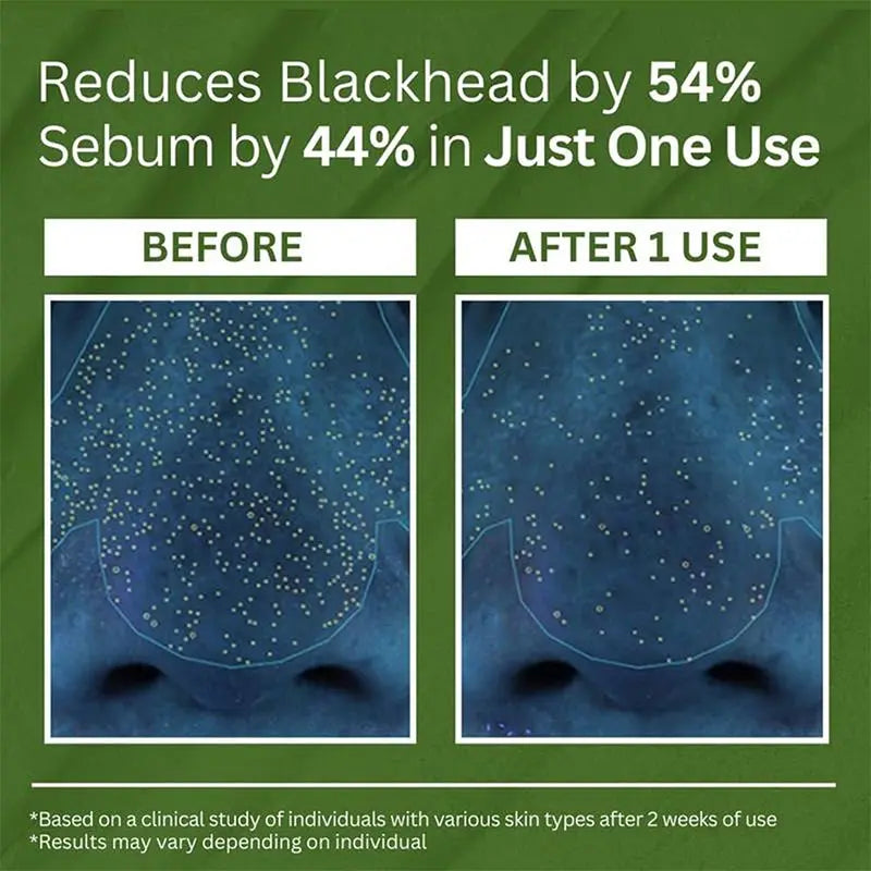 Pore-cleansing Bubble Mask Korean Skincare Sparkling Holy Basil + PHA 13% Gentle Blackhead Removal Oil Control Cleansing Mask