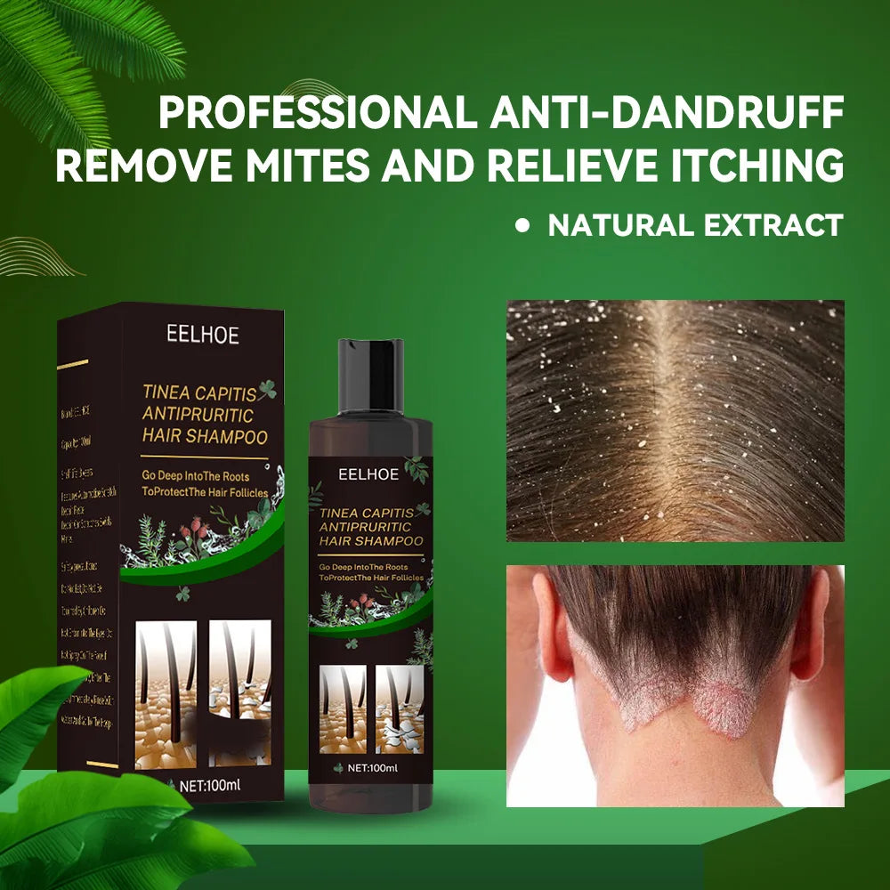 EELHOE Anti It-ching Shampoo Hair Growth Moisturizing Dry Frizzy Repair Damaged Hair Roots Strengthen Cleaning Scalp Treatment